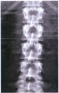 Kwestie van een ruggengraat hebben…